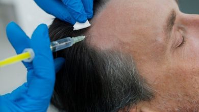 hair-loss-solutions-with-prp-treatment