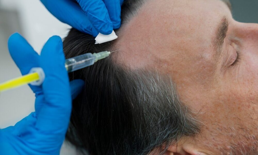 hair-loss-solutions-with-prp-treatment