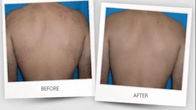 why-rochester-residents-are-saying-goodbye-to-razors-for-good